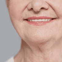 Veneers Cost in Turkey - Best Dental Clinics & Prices